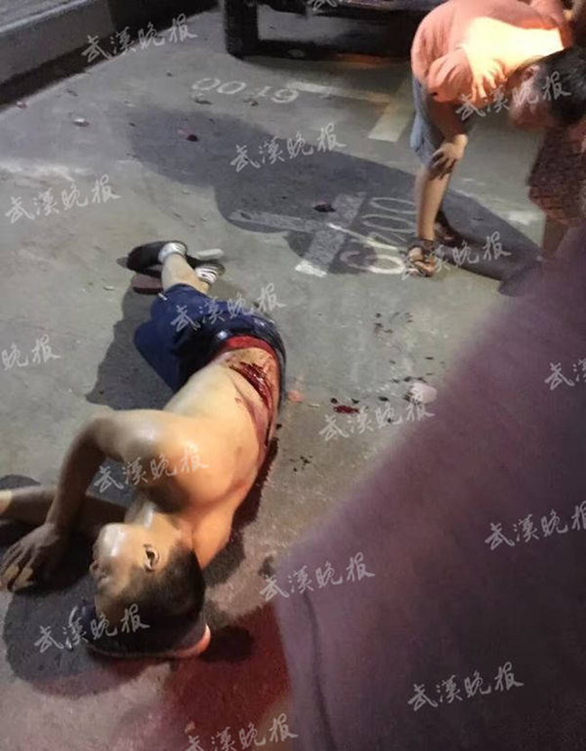 觸目驚心?。?！又現(xiàn)瓷磚脫落傷人案一死一傷